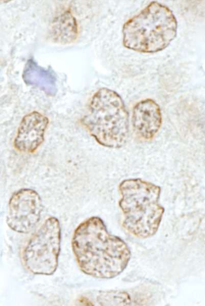 NABP2 Antibody (aa161-211)