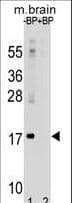 Polyclonal Rabbit anti-Human MAP1LC3A / LC3A Antibody (aa1-30, IHC, IF, WB)