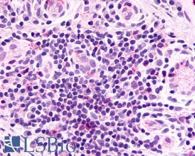 PathPlus™ Polyclonal Rabbit anti-Human CXCR2 Antibody (Extracellular Domain, IHC)