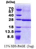 Human KXD1 / C19orf50 Protein (Recombinant His)