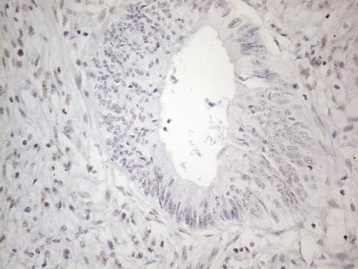 NR2C2 / TAK1 Antibody (aa1-241, clone OTI2H2)