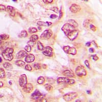 NFKB1 / NF-Kappa-B Antibody (C-Terminus)
