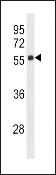 ZNF502 Antibody (aa75-101)