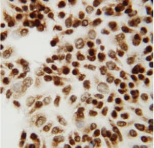 Polyclonal Rabbit anti-Human CTBP2 Antibody (aa429-445, IHC, WB)