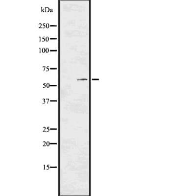 PKM / Pyruvate Kinase, Muscle Antibody (phospho-Tyr105)