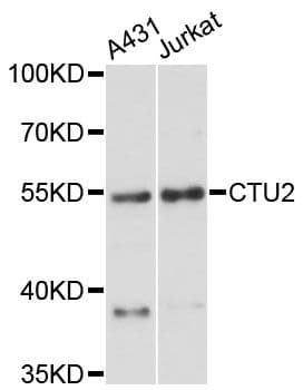 Polyclonal Rabbit anti-Human CTU2 Antibody (WB)
