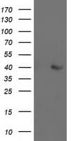 ALDOB Antibody (clone OTI3E10)