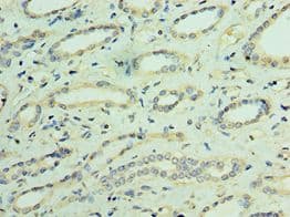 TRPV4 Antibody (aa1-230)