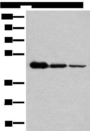 NADK2 / C5orf33 Antibody