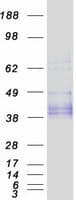 Human Osteoglycin / Mimecan Protein (Recombinant Myc-DDK (Flag))
