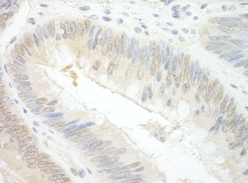 EAF2 / U19 Antibody (aa210-260)