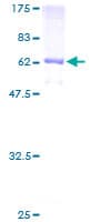 Human CD207 / Langerin Protein (Recombinant GST)