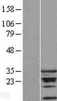 CDCA5 / Sororin Protein (Over-Expression Lysate Myc-DDK (Flag))