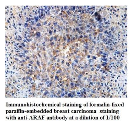 ARAF / ARAF1 / A-RAF Antibody (aa356-539)