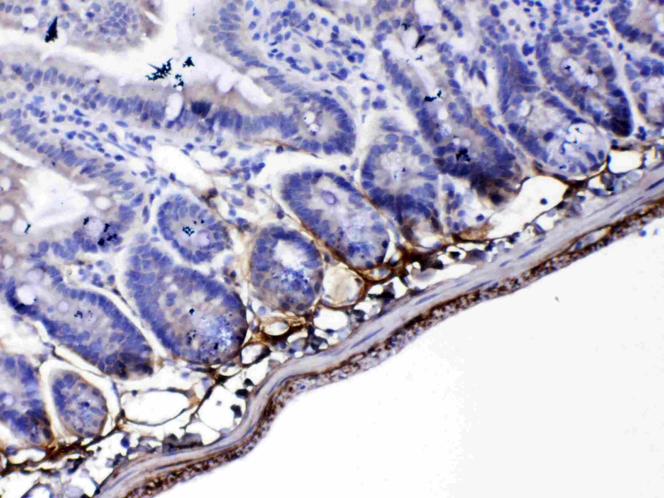 Polyclonal Rabbit anti-Rat POSTN / Periostin Antibody (IHC, WB)