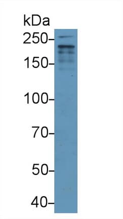 ADAMTS12 Antibody (aa1318-1538)