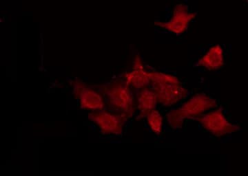 Polyclonal Rabbit anti-Human TUSC5 Antibody (IF, WB)