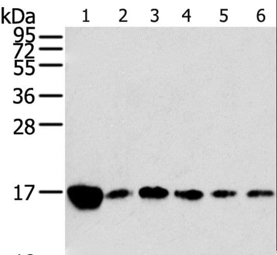 RPLP2 Antibody