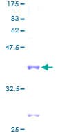 Human RPL35 / Ribosomal Protein L35 (Recombinant GST)