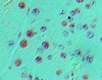 NEUROG3 / NGN3 / Neurogenin 3 Antibody (aa1-50)