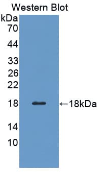 PFN3 Antibody (aa1-133, PE)