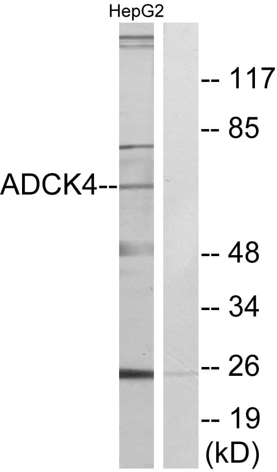 ADCK4 Antibody (aa31-80)