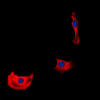 Polyclonal Rabbit anti-Human ERBB4 / HER4 Antibody (C-Terminus, IHC, IF, WB)