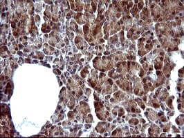 SERPINB3 Antibody (clone OTI1A12)