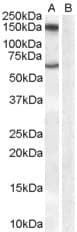 IHC-plus™ MAOB / Monoamine Oxidase B Antibody (aa331-343)