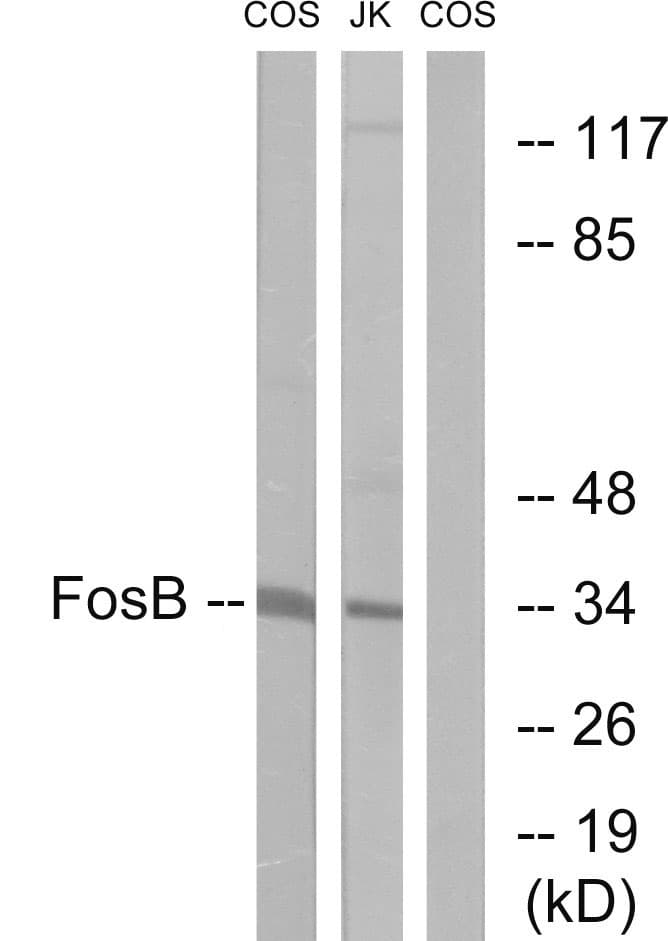 FOSB Antibody (aa12-61)