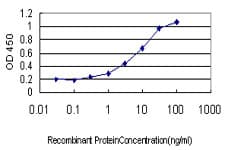 PathPlus™ CD71 / Transferrin Receptor Antibody (clone 1E6)