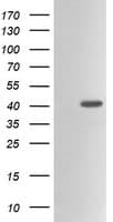 ACAA2 Antibody (clone OTI1D3)
