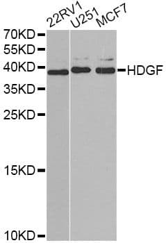 Polyclonal Rabbit anti-Human HDGF Antibody (IF, WB)