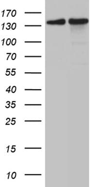 SMC1A / SMC1 Antibody (aa889-1016, clone OTI11E1)
