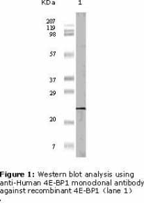 EIF4EBP1 / 4EBP1 Antibody (clone 11G12C11)