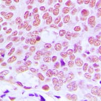 Polyclonal Rabbit anti-Human JUN / c-Jun Antibody (Internal, IHC, WB)