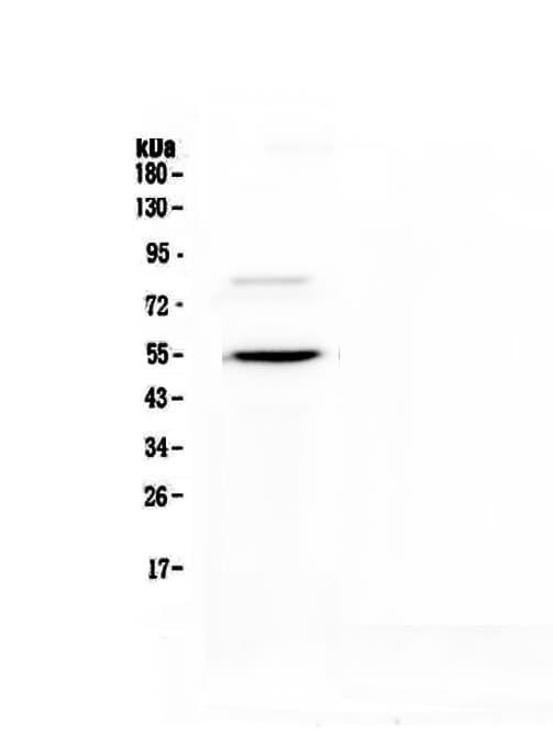 Polyclonal Rabbit anti-Human ANGPTL3 Antibody (WB)