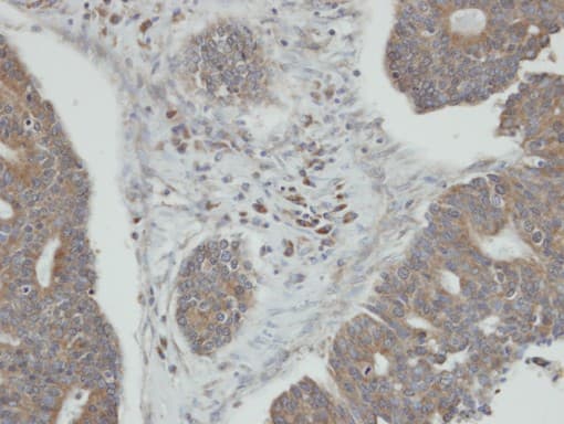 PPM1K Antibody (aa1-364)