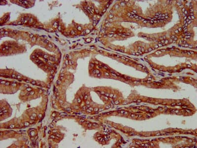 SLC14A1 / JK Antibody