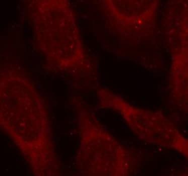 PRMT4 / CARM1 Antibody (phospho-Ser228)