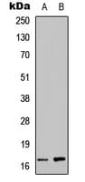 Angiogenin / ANG Antibody (Internal)