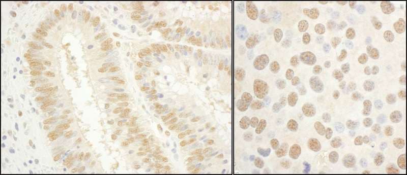Polyclonal Rabbit anti-Human GTF2E1 Antibody (aa389-439, IHC, WB)
