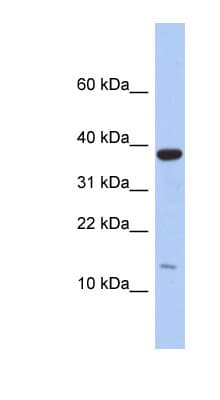 Polyclonal Rabbit anti-Human RPL27 / Ribosomal Protein L27 Antibody (C-Terminus, WB)