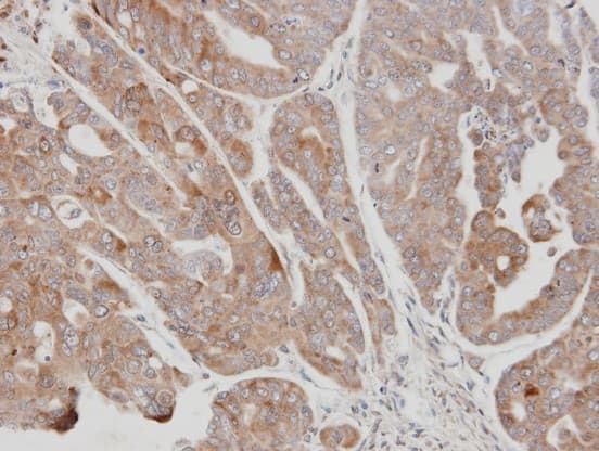 USP15 Antibody (aa920-981)