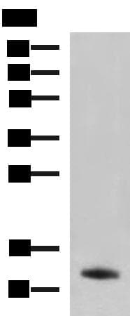 PPY / Pancreatic Polypeptide Antibody