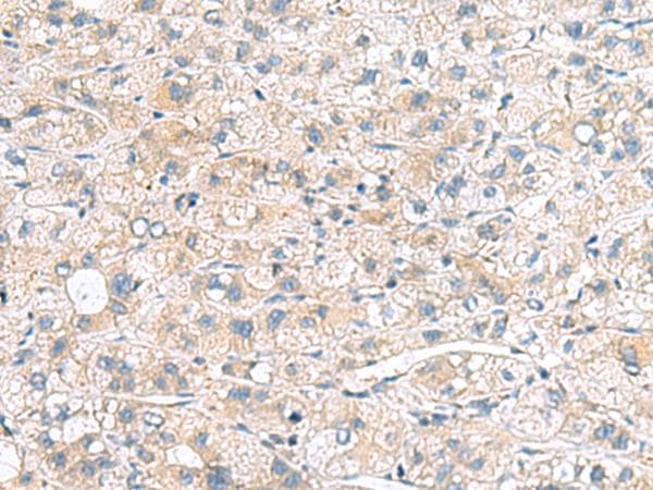 MLC3F / MYL1 Antibody