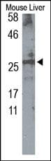 Polyclonal Rabbit anti-Human MPZ / P0 Antibody (IHC, WB)
