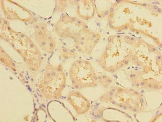 CCDC112 / MBC1 Antibody (Coiled-coil domain)