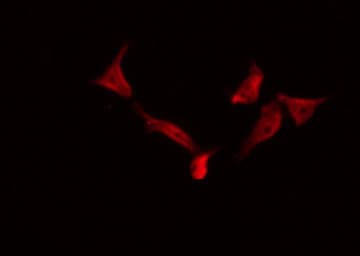 Polyclonal Rabbit anti-Human PSEN1 / Presenilin 1 Antibody (IHC, IF, WB)