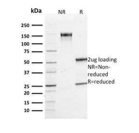 VCL / Vinculin Antibody (clone VCL/2573)